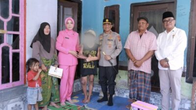Kapolda NTB Jenguk Korban Tersulut Api di Ponpes di Lombok Tengah, Janji Kawal Restitusi dan Tuntaskan Kasus